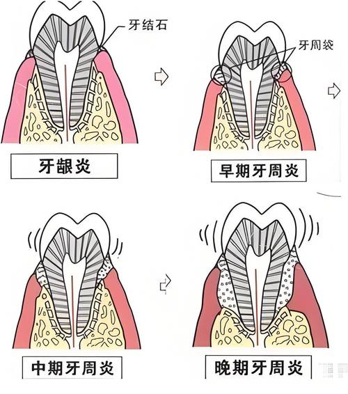 舌根和牙龈被缝一起,舌根和牙龈被缝一起怎么办